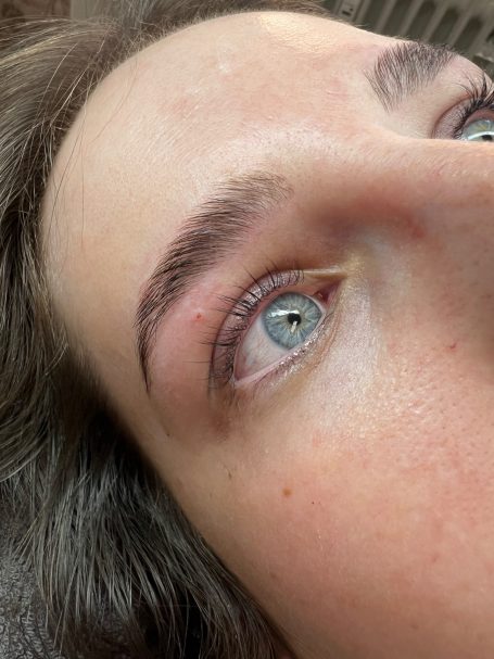 Testemonial-Foto, Frau nach Augenbrauen.- Browlifting