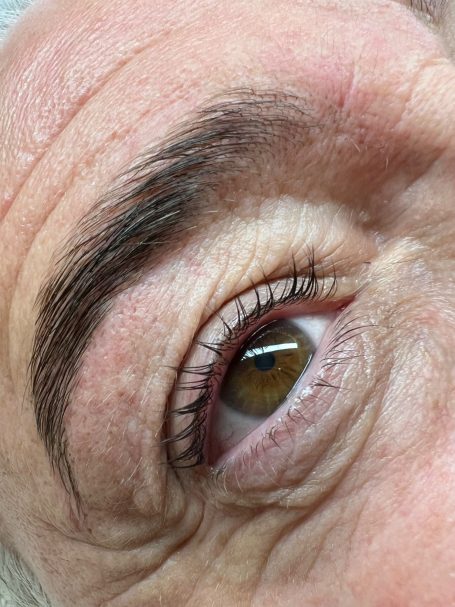 Referenzbild, Mann nach Augenbrauen.- Browlifting